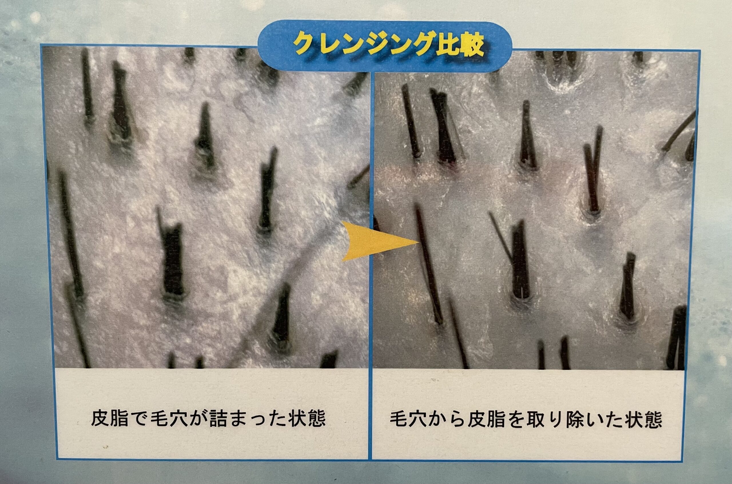 美容室Ring米子/頭皮のにおい